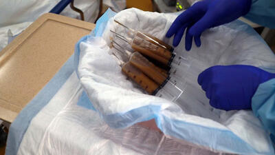 Gloved hands reach toward five large syringes filled with dark liquid in a bin.