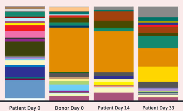 Colorful bar chart depicting bacteria range in a patient and donor over the course of a fecal transplant, from day 0 to day 33. 