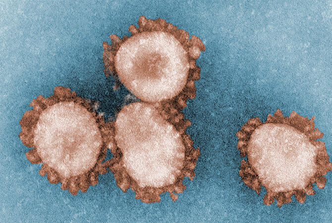colorized transmission electron microscopic image of four human coronavirus 229E particles