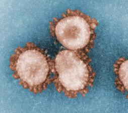colorized transmission electron microscopic image of four human coronavirus 229E particles