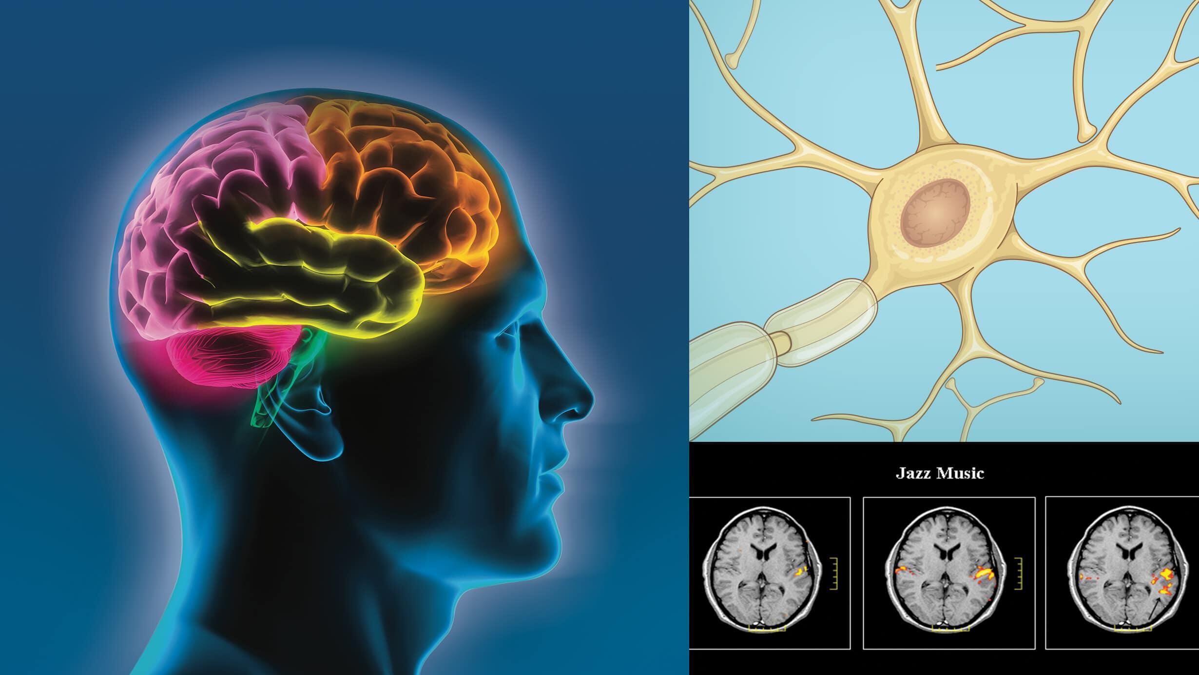 collage showing: a man's head with different parts of the brain highlighted; three brain scan images; and a neuron with branches. 