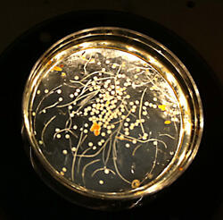 A petri dish with tiny light-colored round pieces and long thin string-like items.