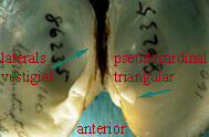 Open interior shell halves of the Alasmidonta undulata triangle floater, with titling locating its hinge teeth, vestigial laterals, pseudocardinal triangular, and anterior.