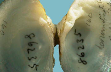 Close-up of the hinge of a bivalve mollusk, an Alasmidonta undulata, shows strong pseudocardinal teeth and vestigial laterals.