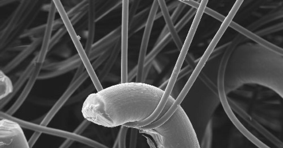 через микроскоп. микроорганизмы под электронным микроскопом. коловратки сканирующий микроскоп. магнитная головка hdd. споры сфагнума под микроскопом.