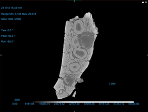 3D scan of maxilla toothrow with text and numbers that indicate size, range min and max, and degrees of yaw, pitch, and roll.