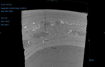 3D xray of femur with text and numbers indicate size, range min and max, and degrees of yaw, pitch, and roll.