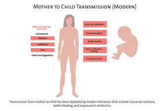 Graphic titled "Mother to Child Transmission (Modern) showing transmission has decreased with modern behaviors such as bottle feeding and antibiotics.