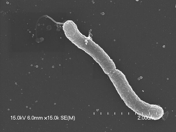 H. Pylori against dark background.