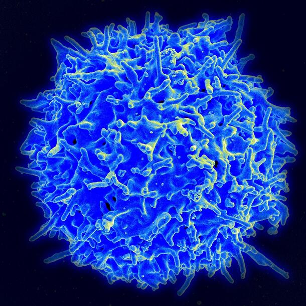 Close-up view of a human T-cell, a colorful, textured sphere, seen through a scanning electron microscope.